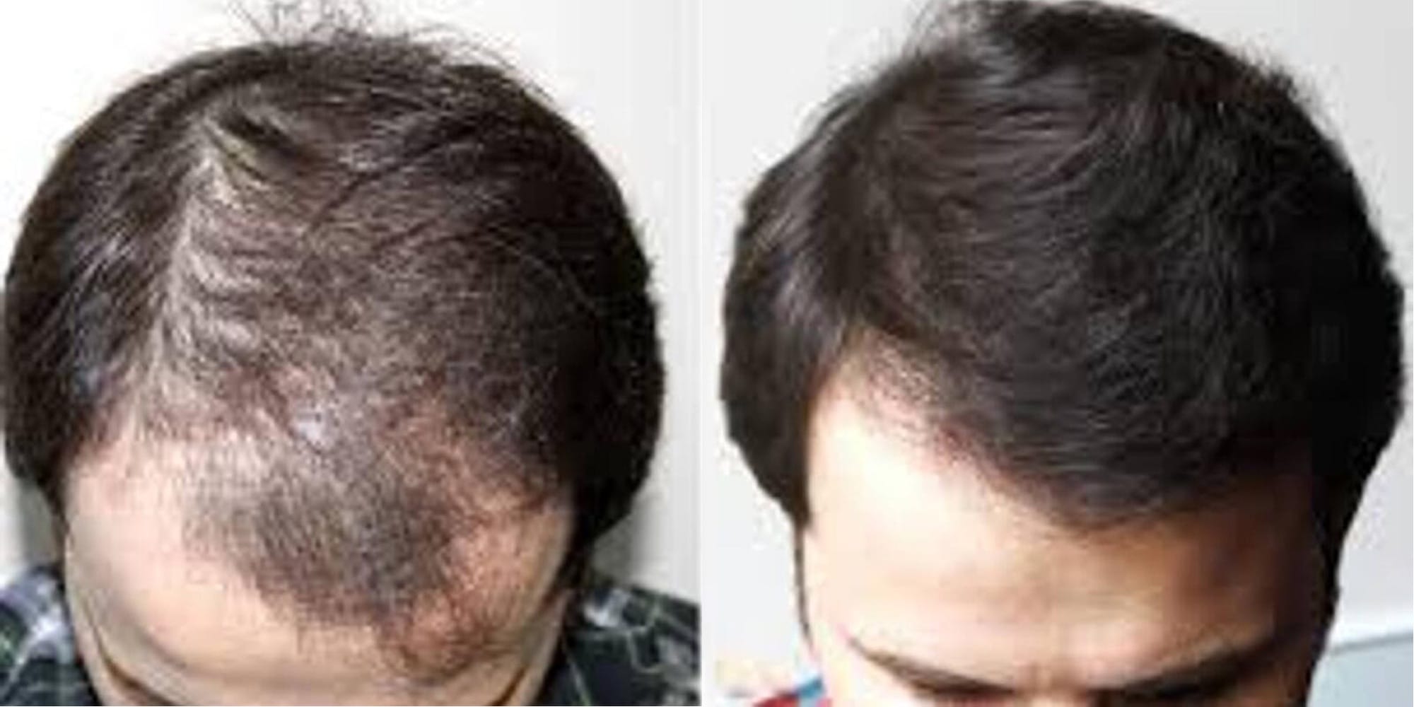 Hair Before & After Image
