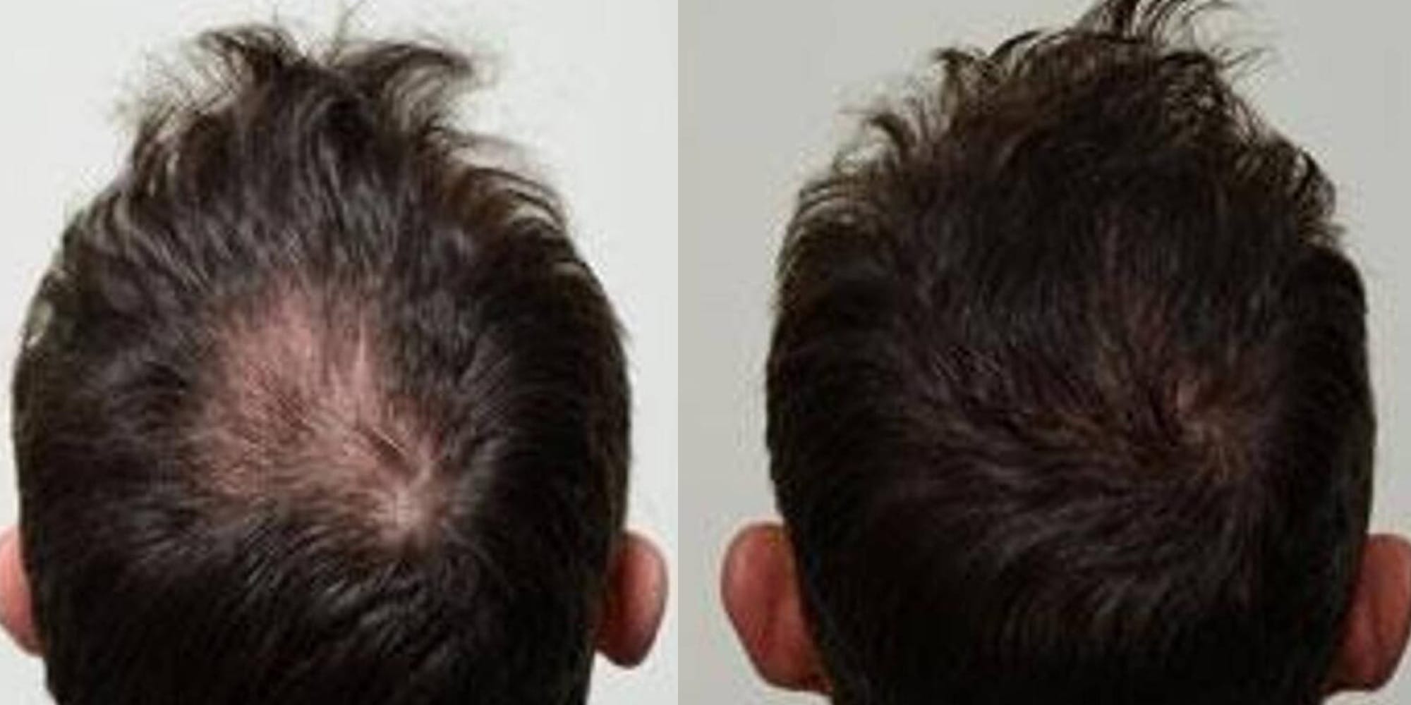 Hair Before & After Image